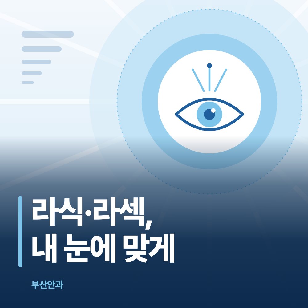 라식·라섹, 내 눈에 맞게